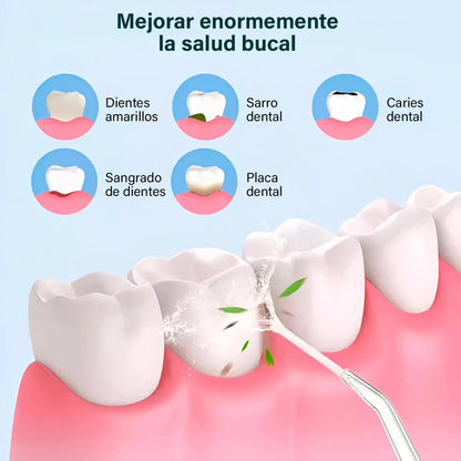 IRRIGADOR ORAL 0-SARRO RECARGABLE